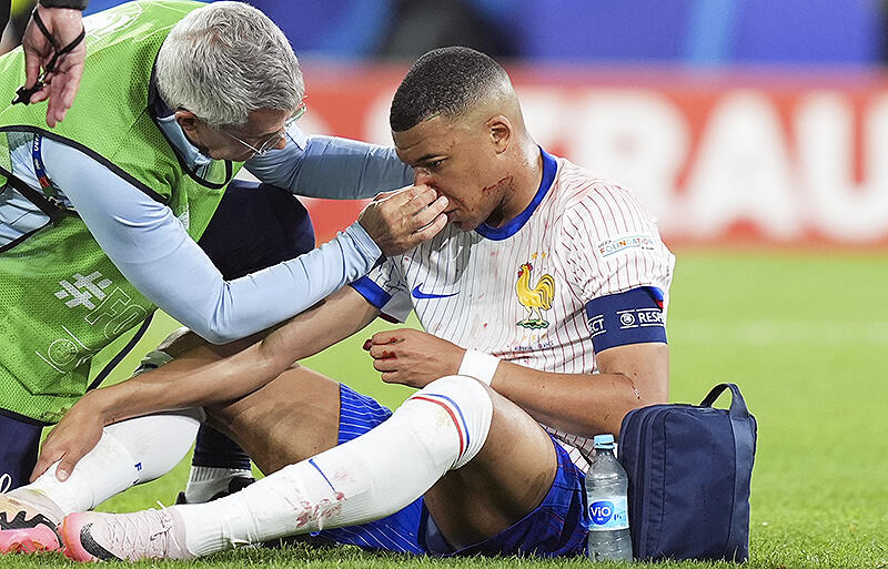 オーストリア戦で負傷したムバッペ