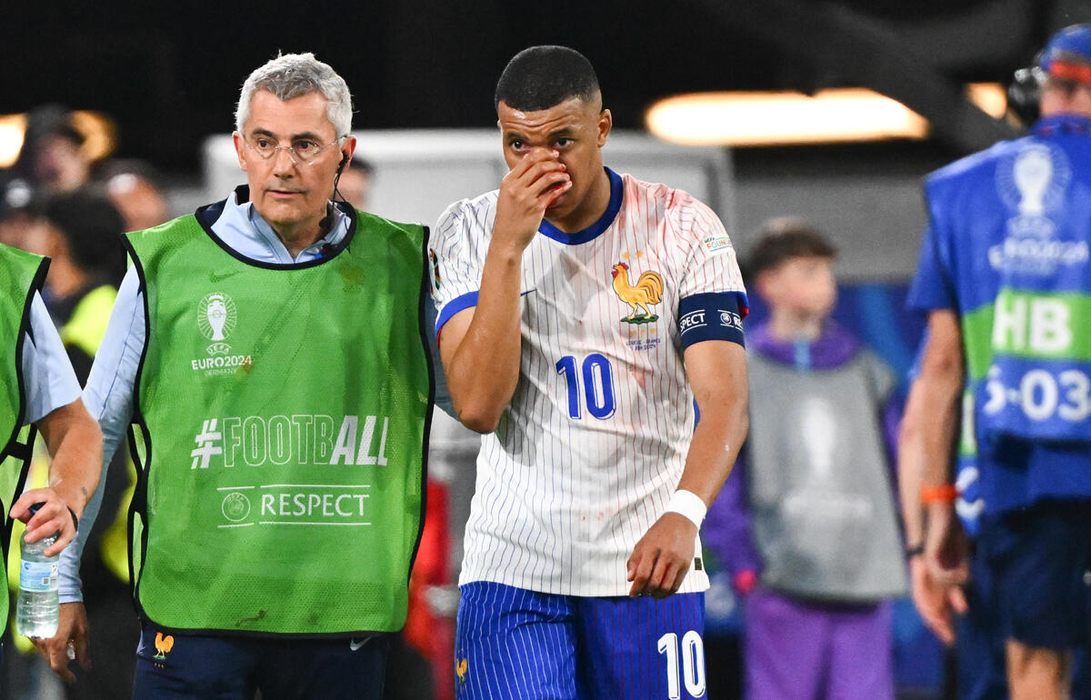 試合終盤に流血したムバッペ