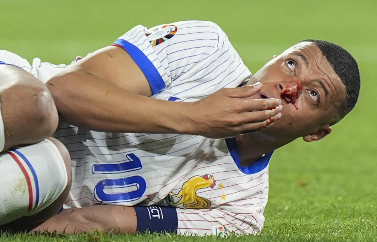 鼻を骨折し流血したムバッペ