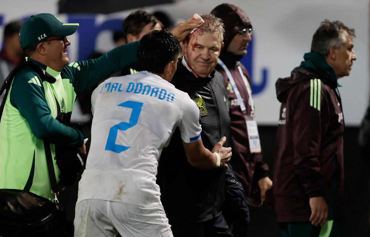 相手サポーターの投げた缶があたり流血するアギーレ監督