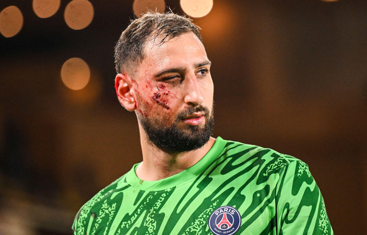 顔面を踏みつけられたドンナルンマ